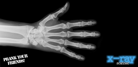 X-Ray Scanner