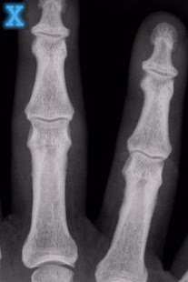 X-Ray Scanner