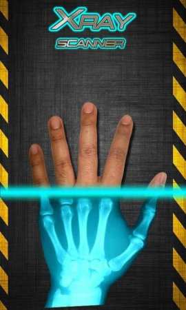 Android Röntgen Çekme Xray Scanner Prank Uygulaması