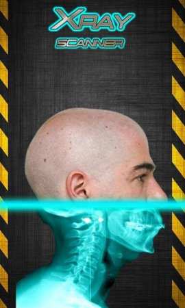 Android Röntgen Çekme Xray Scanner Prank Uygulaması
